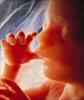 سقط جنین چیست