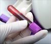 آزمایش اندازه گیری غلظت کلسترول خون (گزارشکار آزمایشگاه)